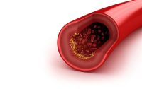 B-vitaminen en homocysteïne