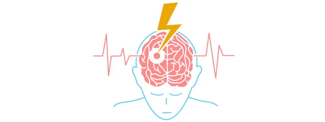 Meting thiaminetekort van belang voor herstel na beroerte