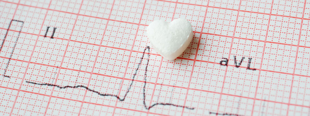 Magnesium voorkomt hartritmestoornis