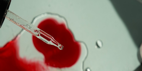 Methionine en threonine voor hemoglobine