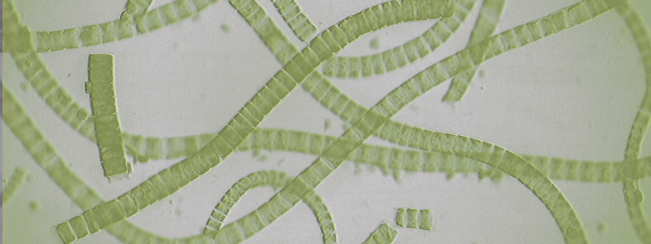 De rol van het microbioom bij post-acute infectieuze syndromen