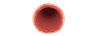 Vitamine C beschermt endotheel