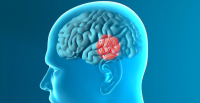 Co-enzym Q10 en parkinson: dosisstudie