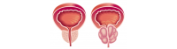Zink nuttig bij prostatitis