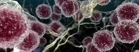 Nutritioneel supplement tegen multiple sclerose
