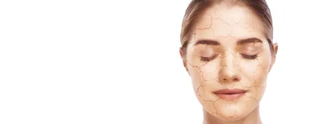 Collageen, ceramiden, hyaluronzuur, en procyanidine hydrateren huid