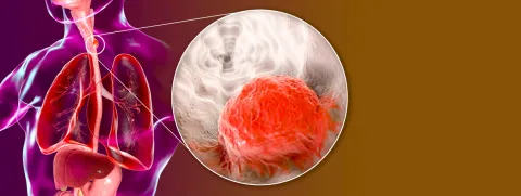 Na slokdarmresectie treden voedingstekorten op