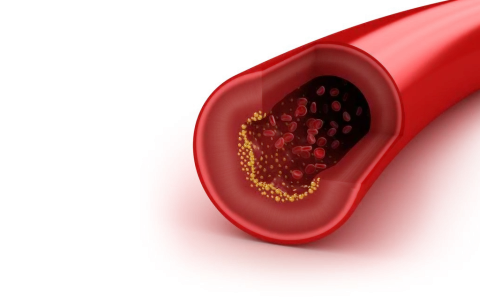 Cholesterol is niet ongezond