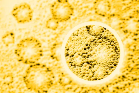 Curcumine verbetert symptomen colitis ulcerosa