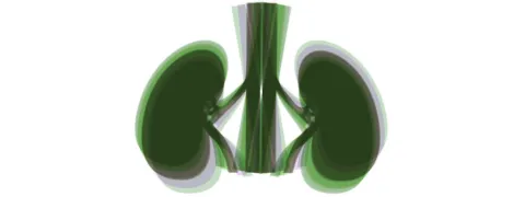 Grotere kans op hyperfiltratie nieren bij vitamine D-tekort 