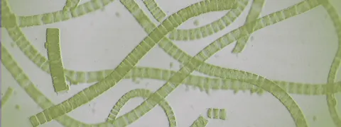 De rol van het microbioom bij post-acute infectieuze syndromen