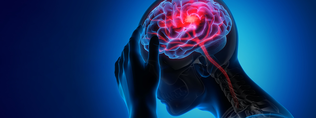 Carnitine en risico op cognitieve schade na herseninfarct
