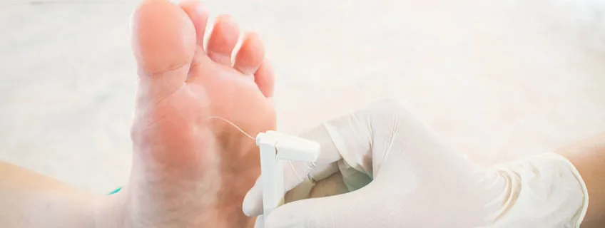 Associatie tussen ijzerinname en diabetische neuropathie