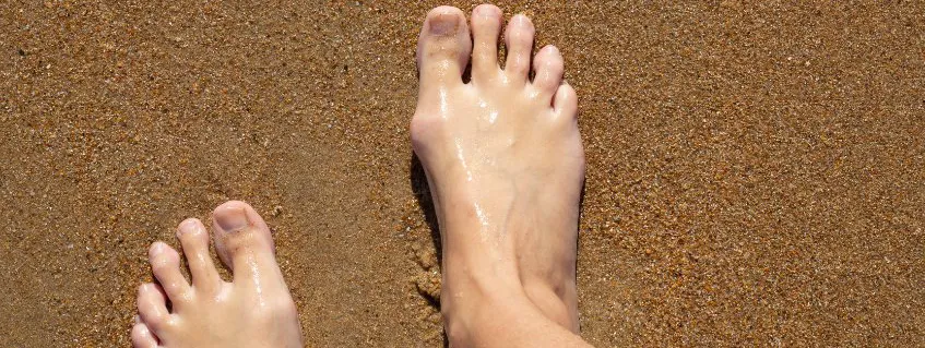 Vitamine C niet vitamine E tegen jicht