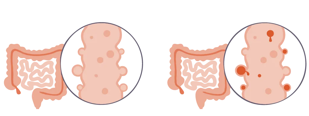 Mucuslaag van de darmen