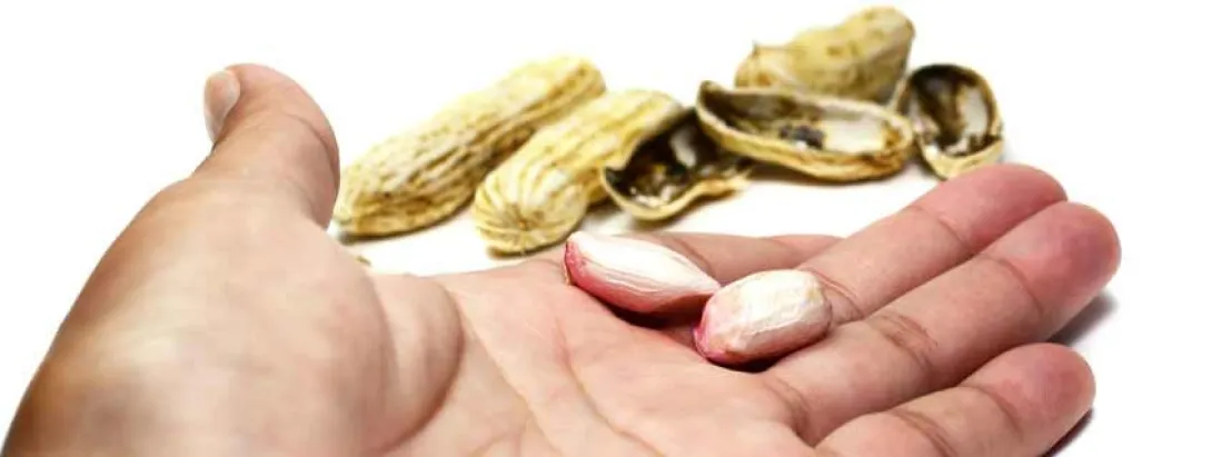 Immuuntherapie heeft beperkt resultaat bij pinda-allergie