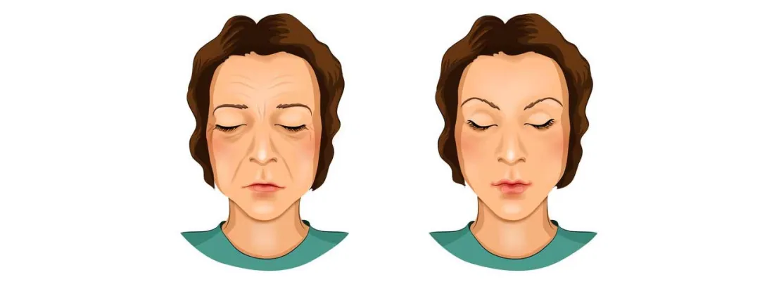 Suppletie met collageen tegen huidveroudering