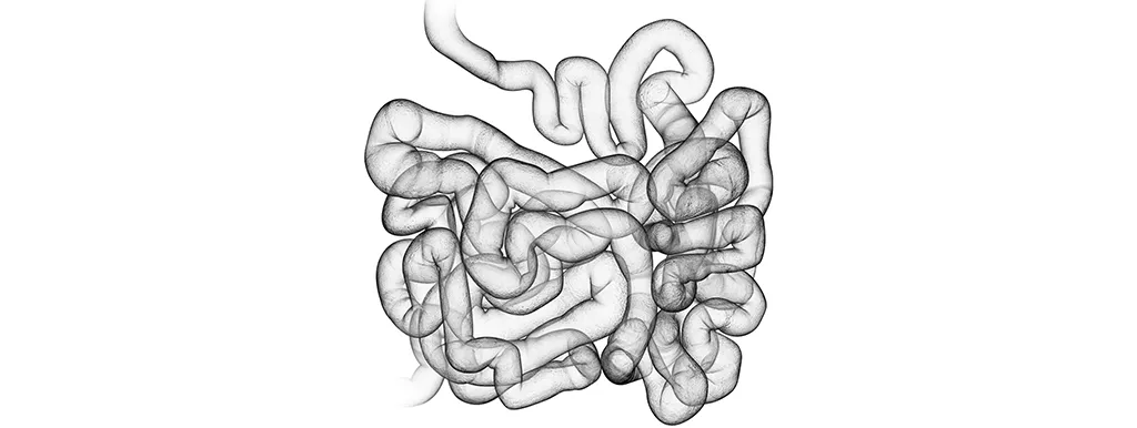 Mediterrane voeding tegen colitis