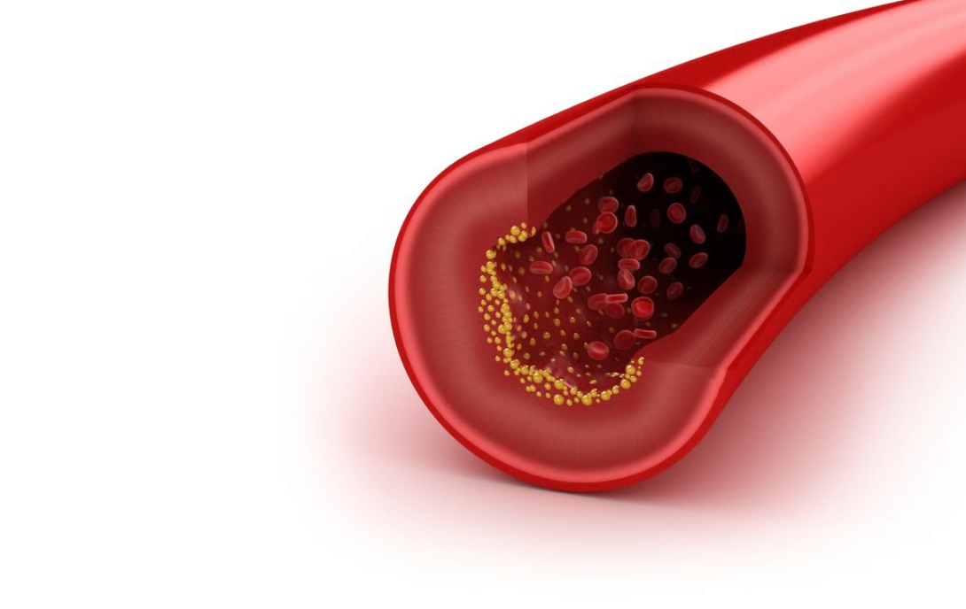 B-vitaminen en homocysteïne