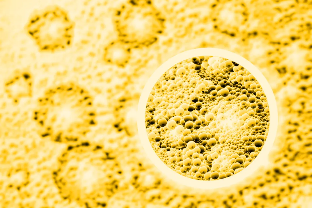 Curcumine verbetert symptomen colitis ulcerosa