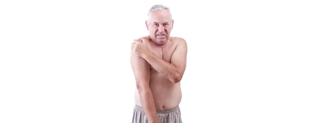 Vitamine D en statine-uitgelokte spierpijn