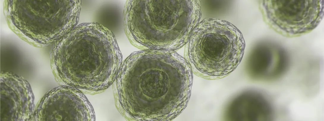 Mast Cell Activation Syndrome