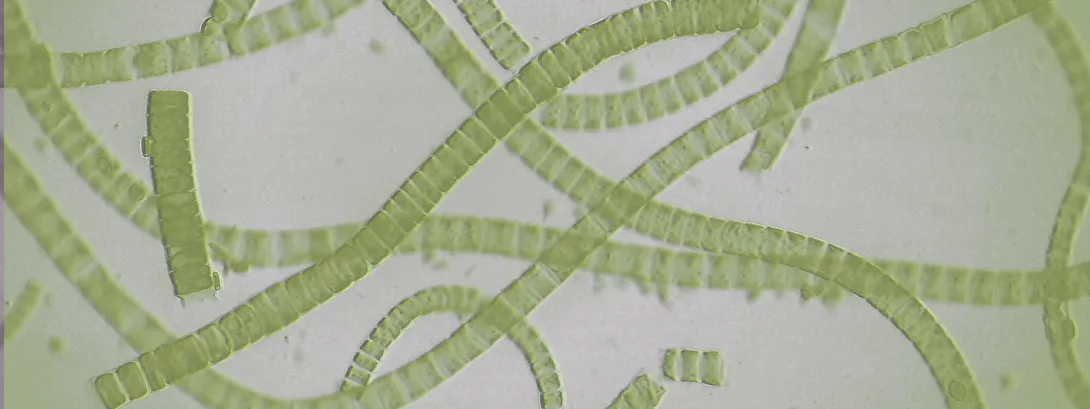 De rol van het microbioom bij post-acute infectieuze syndromen